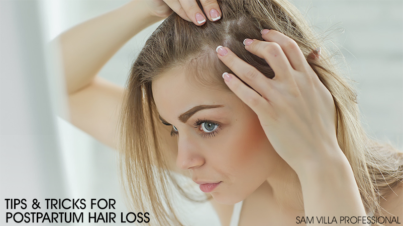 407d07e1227093580646 postpartum hair loss