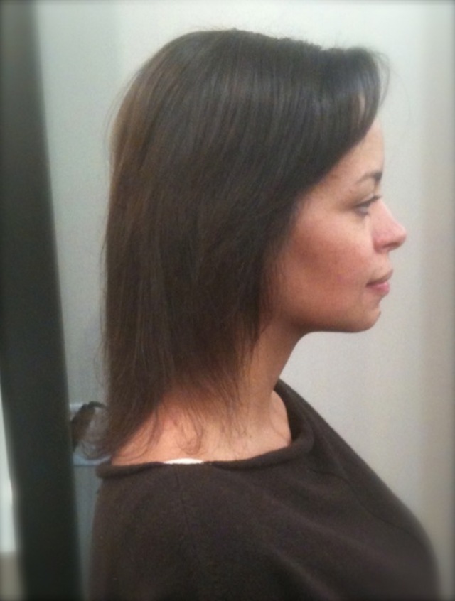 before extensions