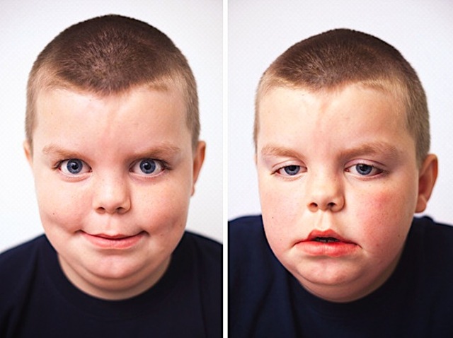 beingbravechildrensurgery