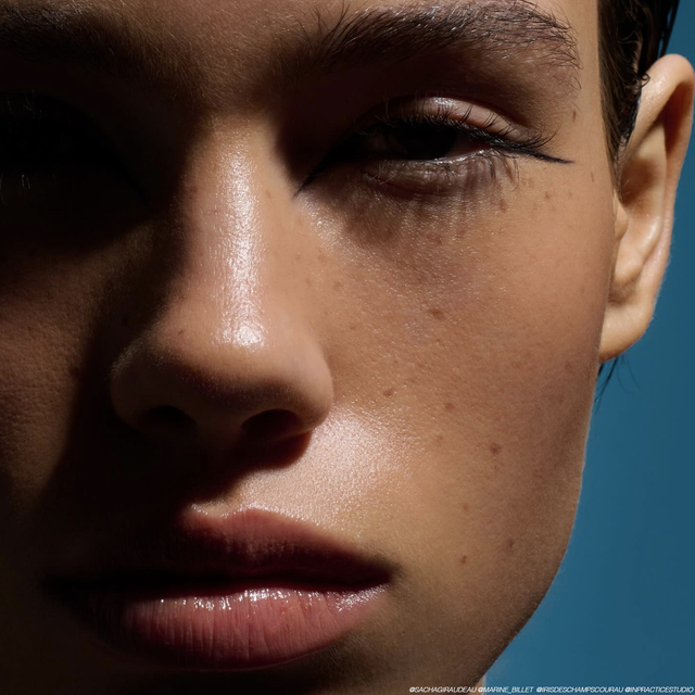 Re sized 6b1aa35bf39efe439eba dry skin