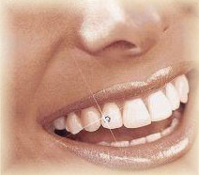 tooth-jewelry-2