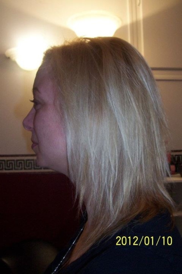 Vanessa Side Before
