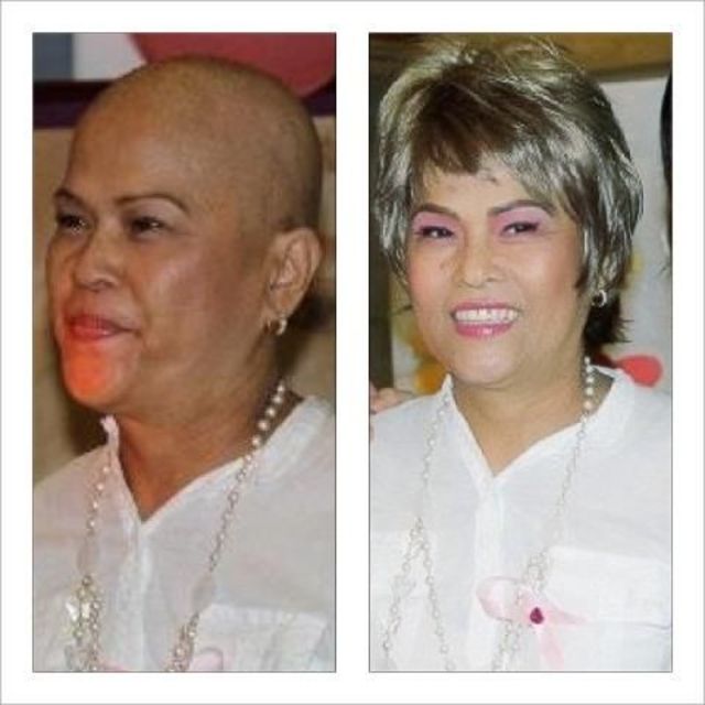BEFOR AND AFTER