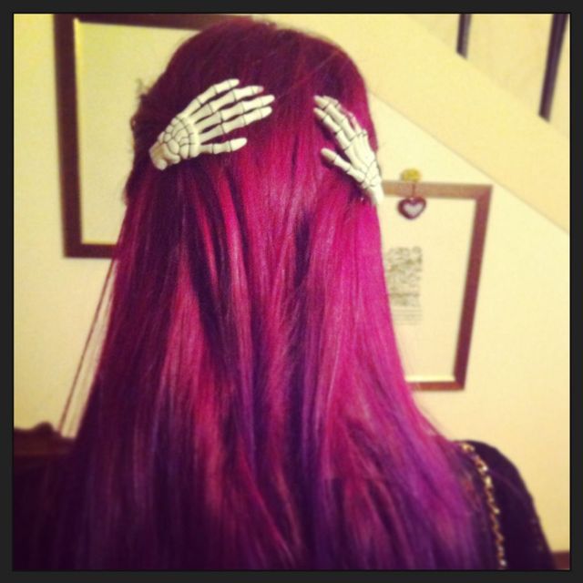 Bones