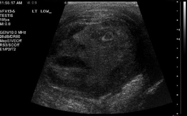 Face_2042115c