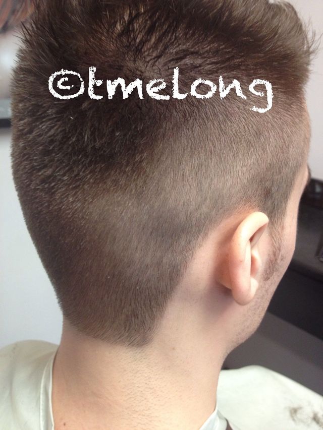 Hairline