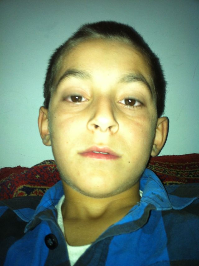 an