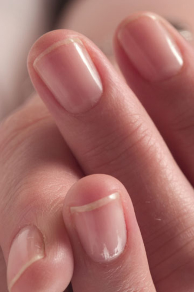 cuticles