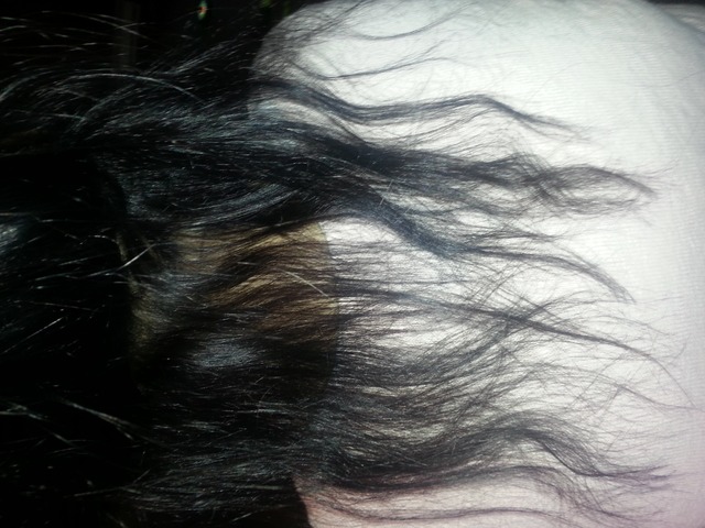 before extensions