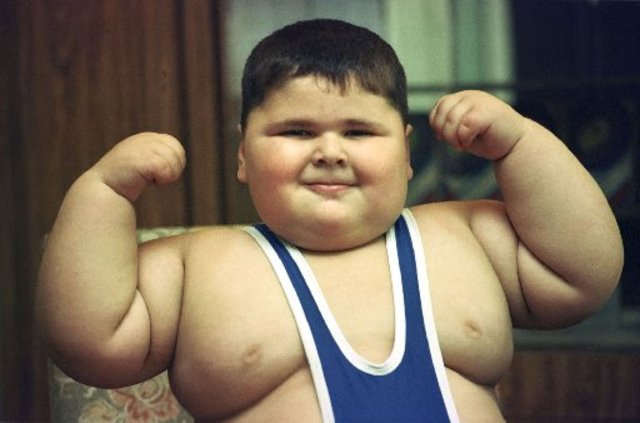 childhood-obesity