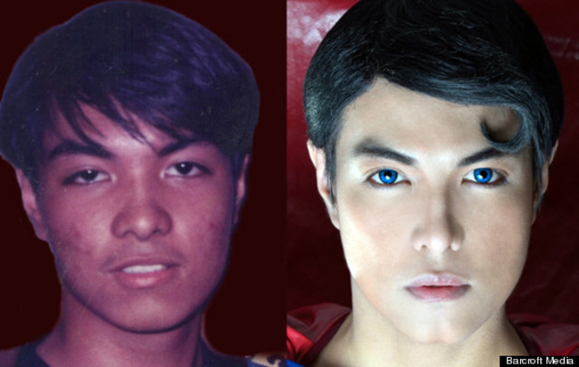 Superman Fan Undergoes Plastic Surgery To Look Like His Favorite Superhero