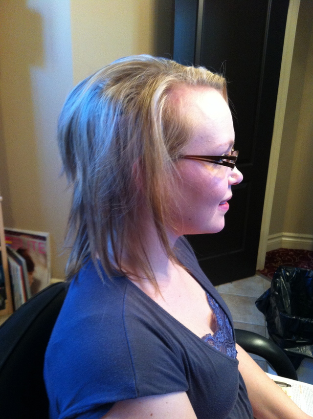 Lauras Before Side
