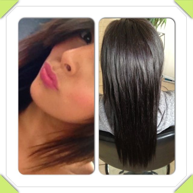 extensions