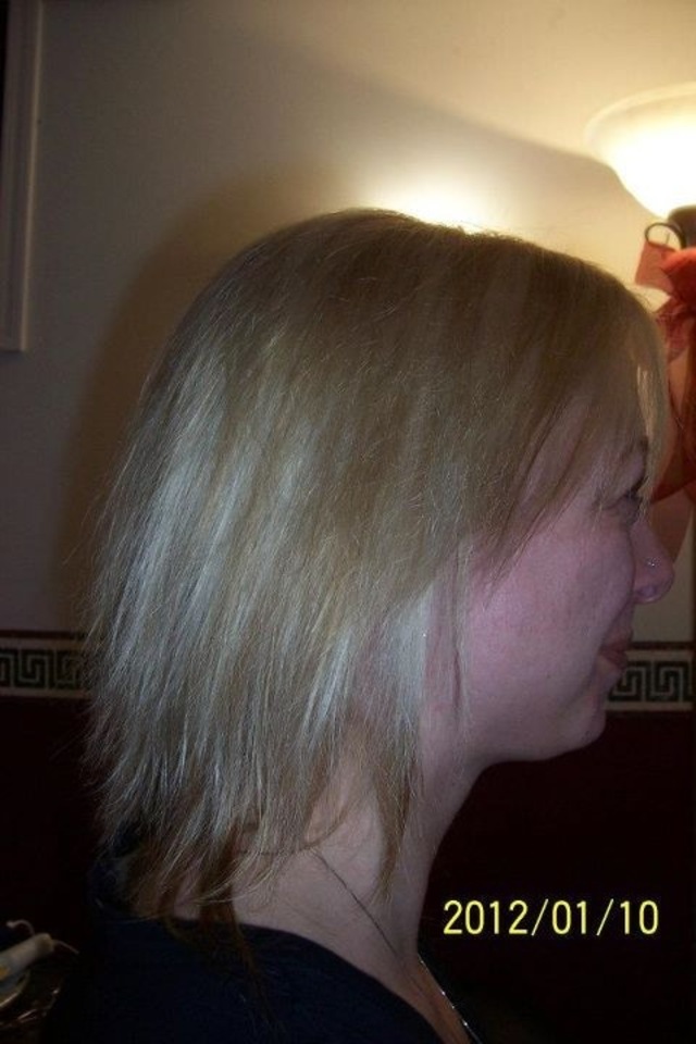 Vanessa Side Before Without Pink 