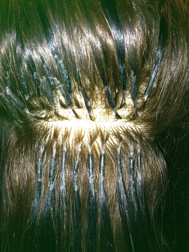 fusion extensions