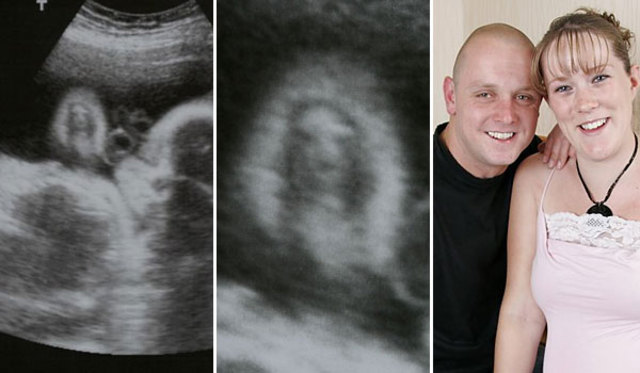jesus_ultrasound