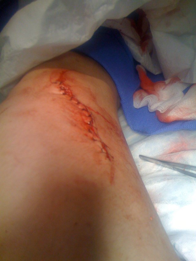 leg3
