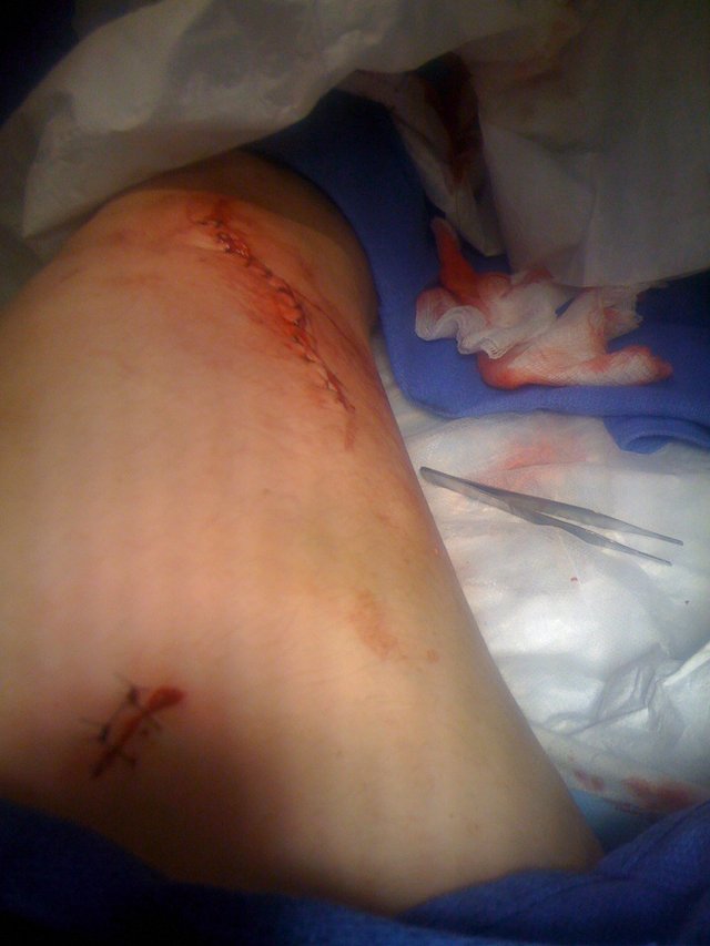 leg4