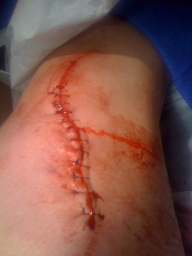 leg5
