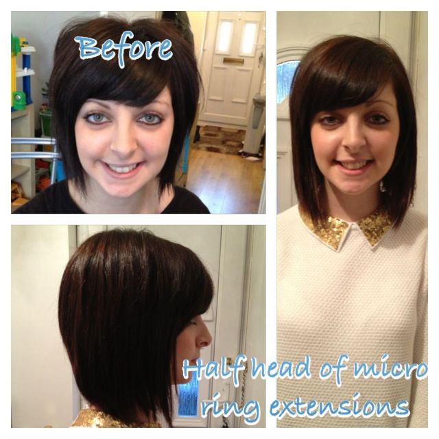 micro ring extension 