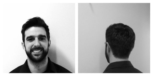 over comb technique 