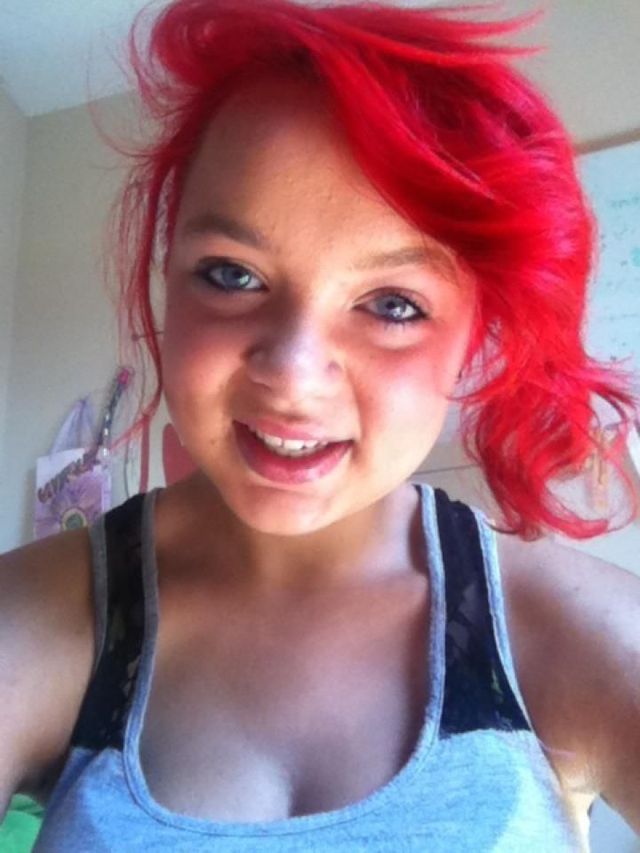 red hair!