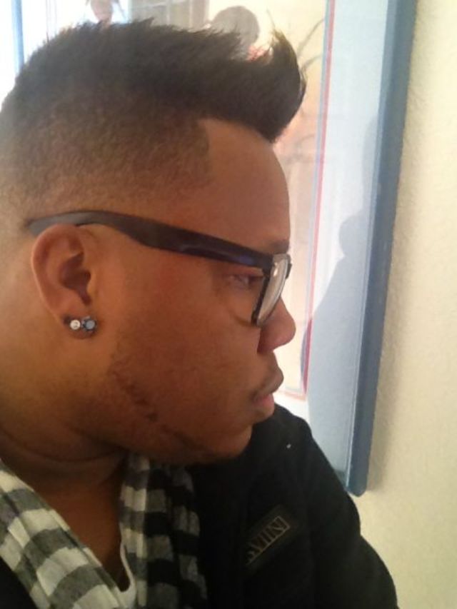the side 